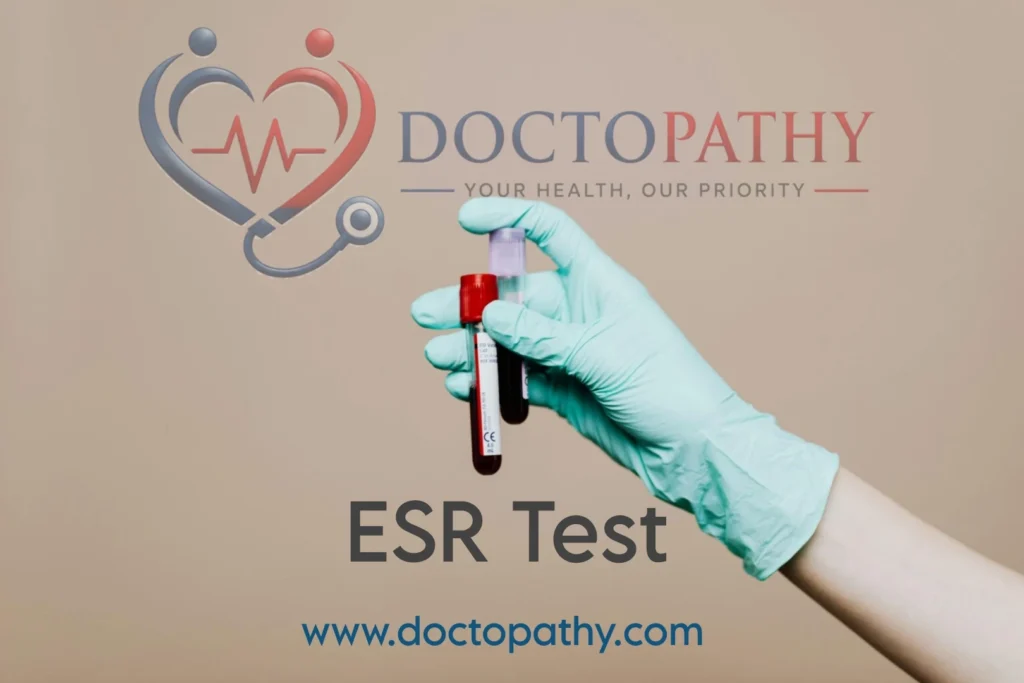 ESR test: Purpose, normal range, procedure and interpretation of results