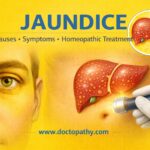 JAUNDICE Causes • Symptoms • Homeopathic Treatment