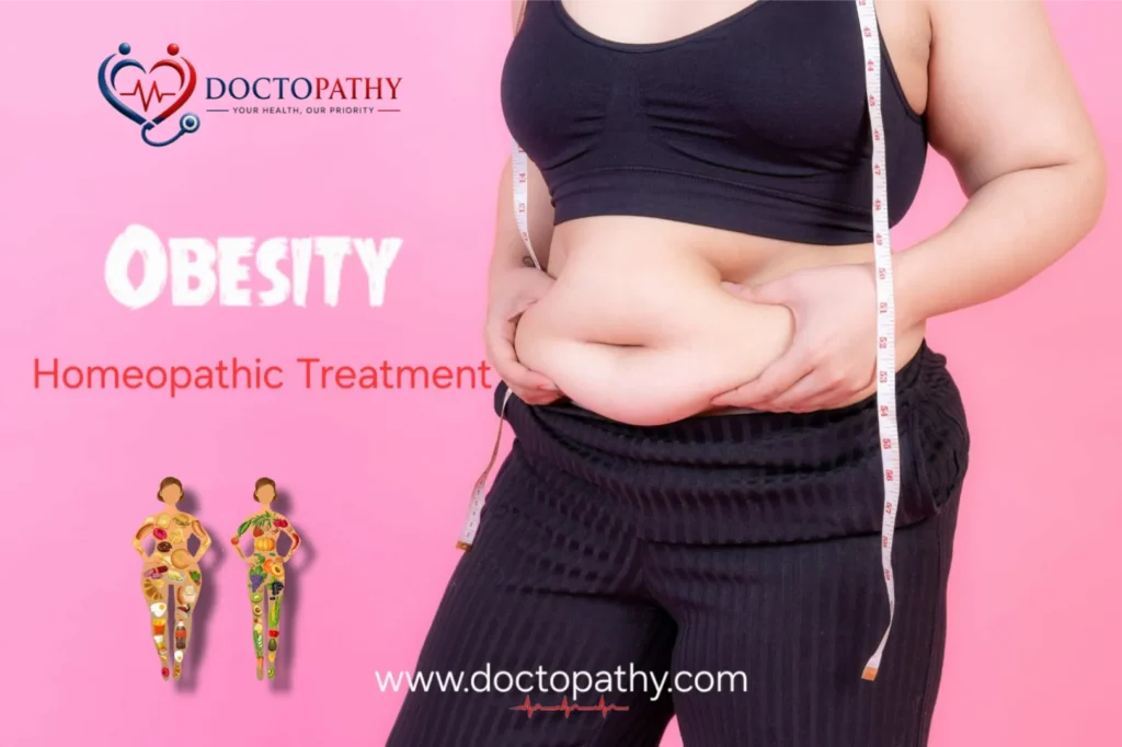 Obesity: Causes, Symptoms, Risks & Homeopathic Treatment