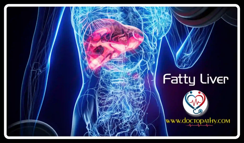 Fatty Liver: Types, Symptoms, Causes, Stages & Treatment