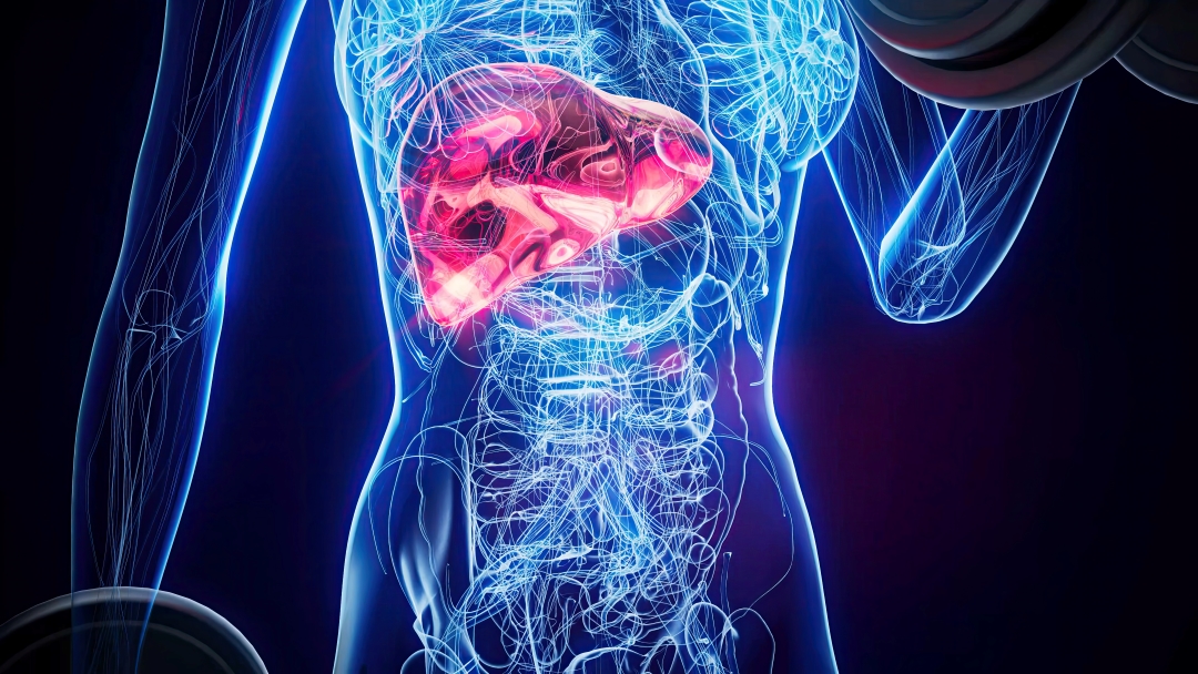 Fatty Liver Disease