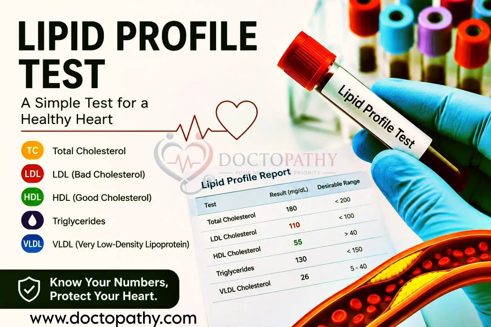 Lipid Profile Test? Complete Guide to Cholesterol Testing - DOCTOPATHY
